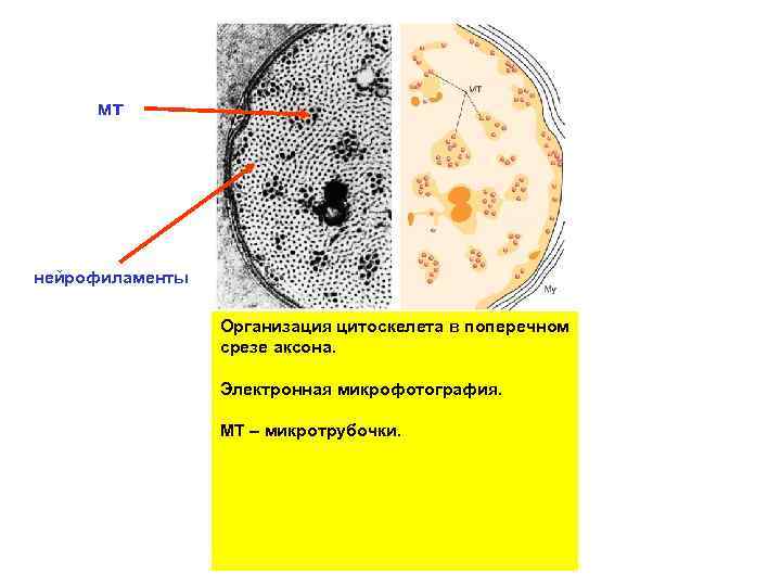 мт нейрофиламенты Организация цитоскелета в поперечном срезе аксона. Электронная микрофотография. МТ – микротрубочки. 