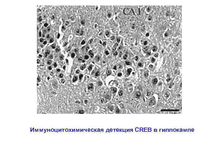 Иммуноцитохимическая детекция CREB в гиппокампе 
