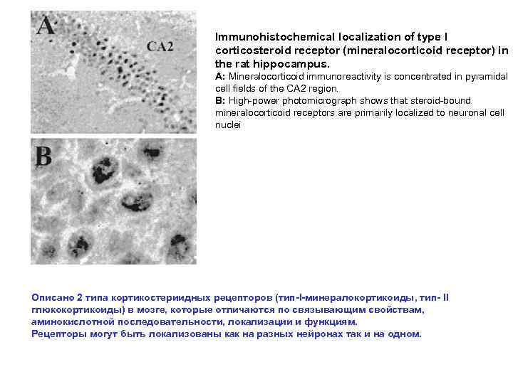Immunohistochemical localization of type I corticosteroid receptor (mineralocorticoid receptor) in the rat hippocampus. A: