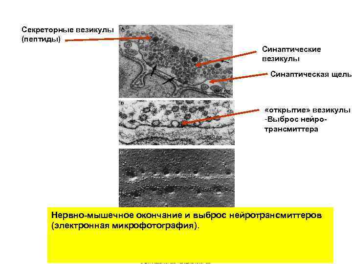 4 везикула. Синаптические везикулы. Секреторная везикула. Секреторные везикулы являются образованием. Везикула нервные окончания.