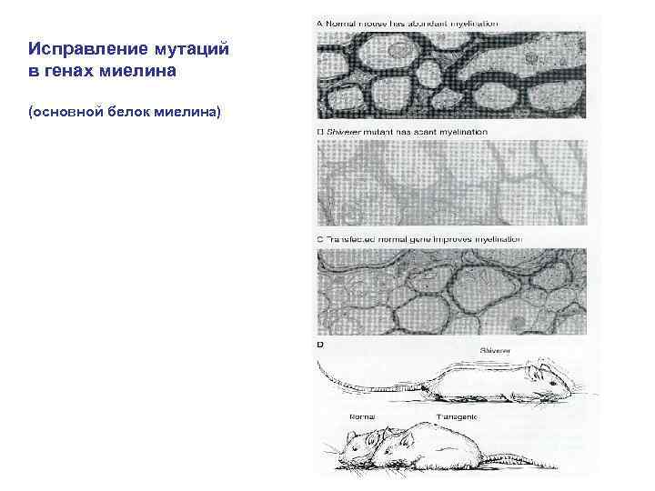 Исправление мутаций в генах миелина (основной белок миелина) 