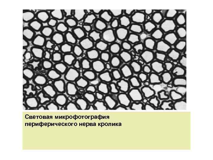 Световая микрофотография периферического нерва кролика 