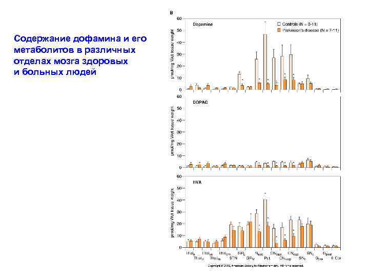 Содержание дофамина и его метаболитов в различных отделах мозга здоровых и больных людей 