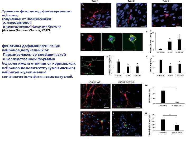 Сравнение фенотипов дофамин-ергических нейронов, полученных от Паркинсоников со спорадической и наследственной формами болезни (Adriana