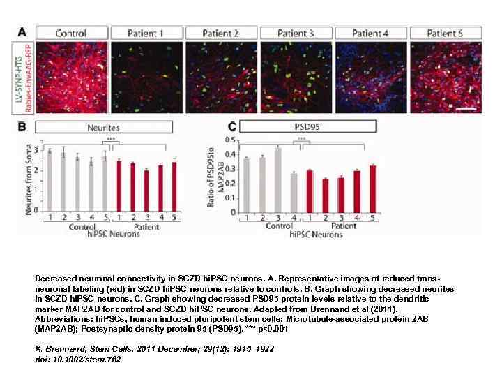 Decreased neuronal connectivity in SCZD hi. PSC neurons. A. Representative images of reduced transneuronal