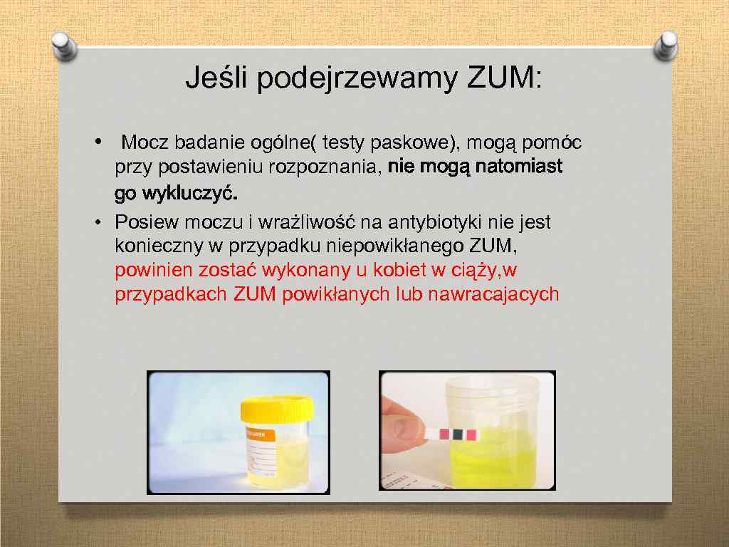 Jeśli podejrzewamy ZUM: • Mocz badanie ogólne( testy paskowe), mogą pomóc przy postawieniu rozpoznania,