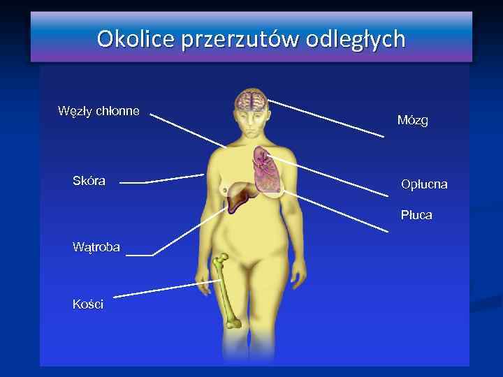 Okolice przerzutów odległych Węzły chłonne Skóra Mózg Opłucna Płuca Wątroba Kości 