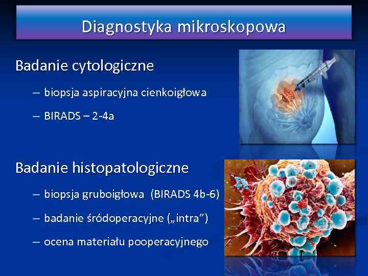 Diagnostyka mikroskopowa Badanie cytologiczne – biopsja aspiracyjna cienkoigłowa – BIRADS – 2 -4 a