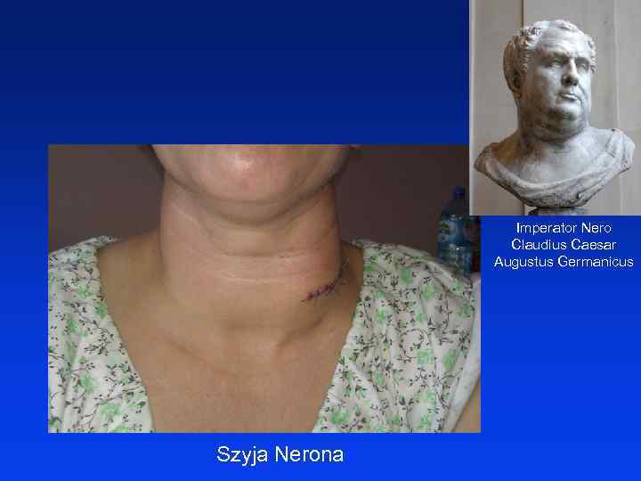 Imperator Nero Claudius Caesar Augustus Germanicus Szyja Nerona 