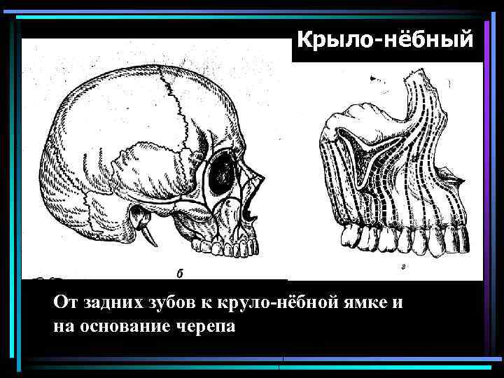 Крыло-нёбный От задних зубов к круло-нёбной ямке и на основание черепа 