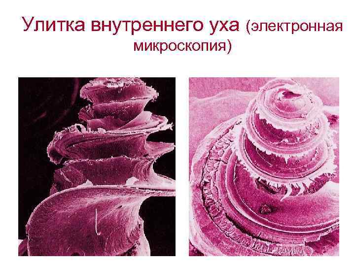 Улитка внутреннего уха (электронная микроскопия) 