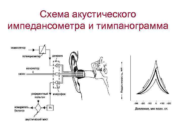 Схема акустического импедансометра и тимпанограмма 