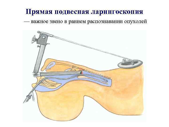 Какие из терминов вошли в активное употребление сознание ларингоскопия файл