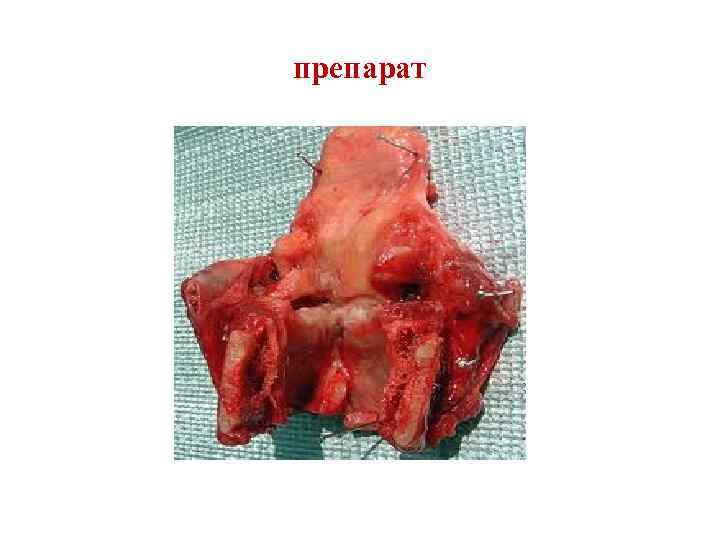 препарат 