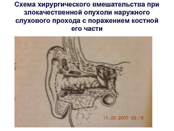 Схема рудько хирургическая стоматология