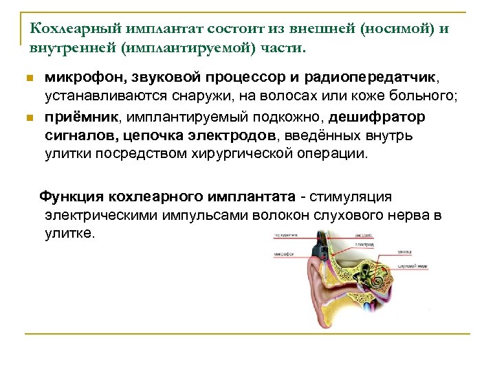 Кохлеарный имплантат состоит из внешней (носимой) и внутренней (имплантируемой) части. n n микрофон, звуковой