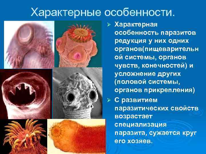 Характерные особенности. Характерная особенность паразитов редукция у них одних органов(пищеварительн ой системы, органов чувств,