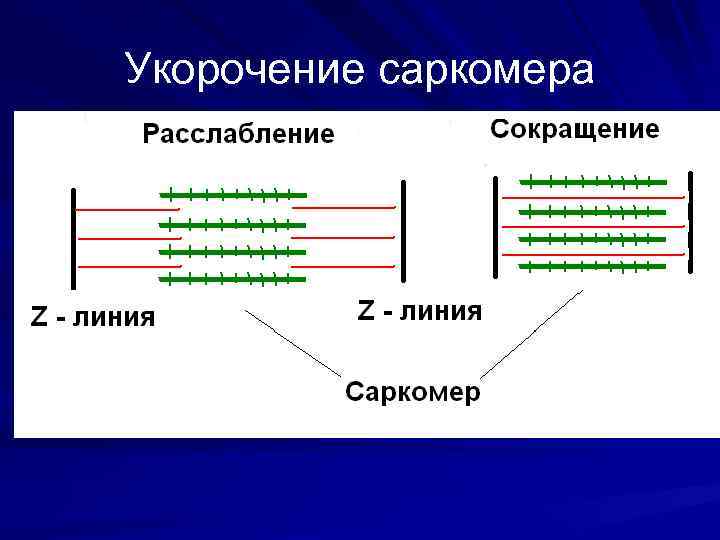 Укорочение саркомера 
