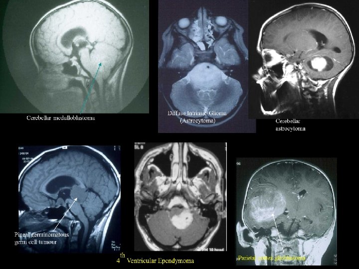 Prof David Walker Professor of Pediatric Oncology 