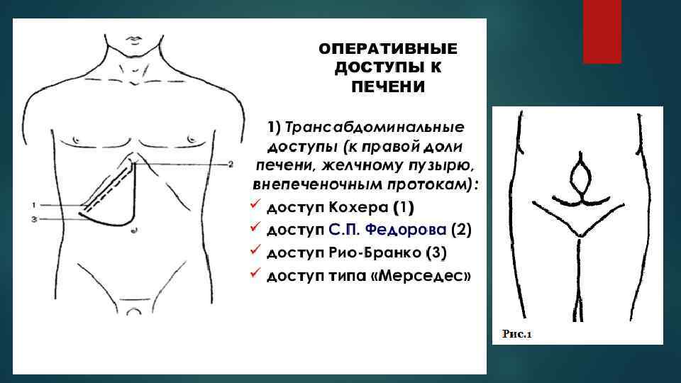 Доступ мерседес к печени