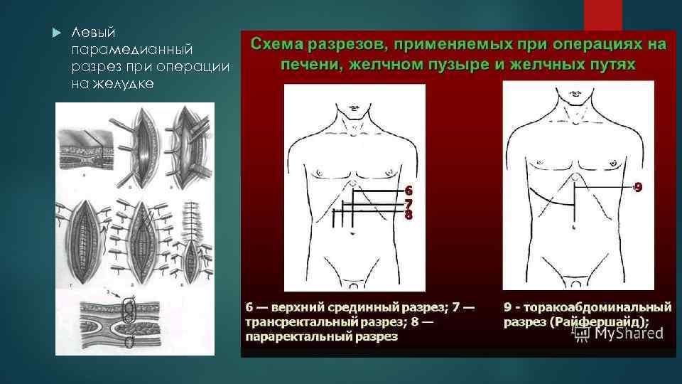 Доступ мерседес к печени