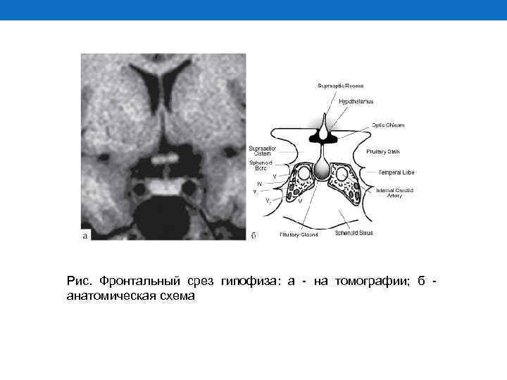 Посмотрите на рисунок 73 нарушение функции гипофиза и рисунок 74 нарушение функции щитовидной железы