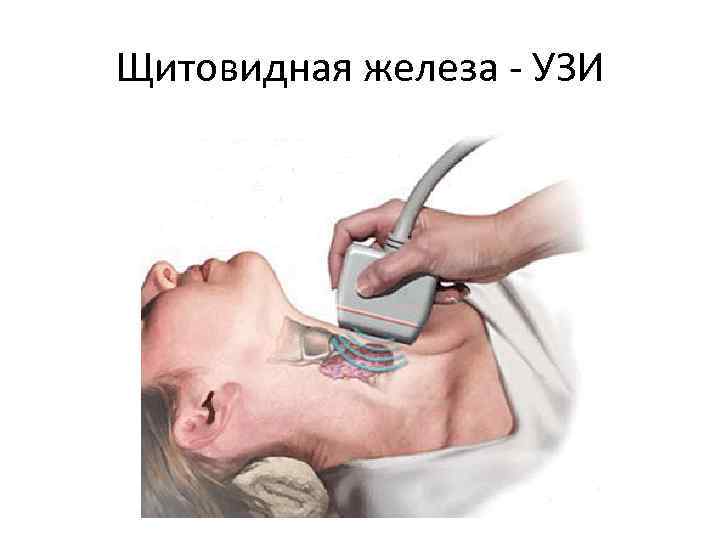 Щитовидная железа - УЗИ 