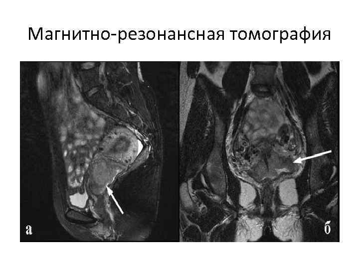 Магнитно-резонансная томография 