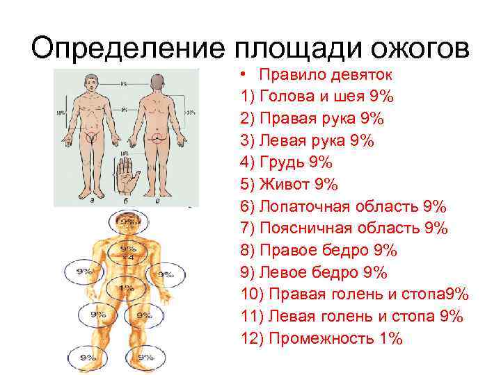 Правило девяток картинка