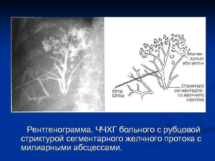 Желчные протоки схема