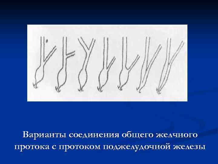 Желчные протоки схема