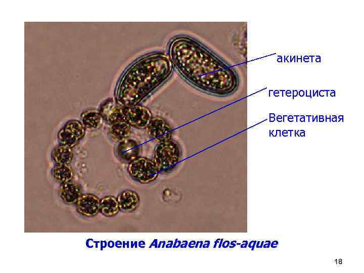 акинета гетероциста Вегетативная клетка Строение Anabaena flos-aquae 18 