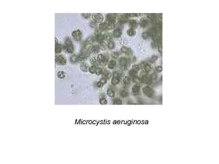Microcystis aeruginosa 
