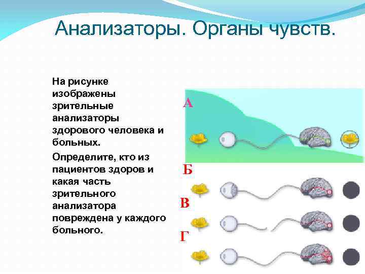 Анализаторы. Органы чувств. На рисунке изображены зрительные анализаторы здорового человека и больных. Определите, кто