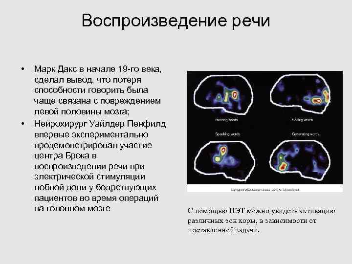 Воспроизведение речи • • Марк Дакс в начале 19 -го века, сделал вывод, что
