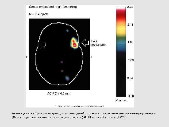 Активация зоны Брока, в то время, как испытуемый составляет синтаксически-сложные предложения. (Левая сторона мозга