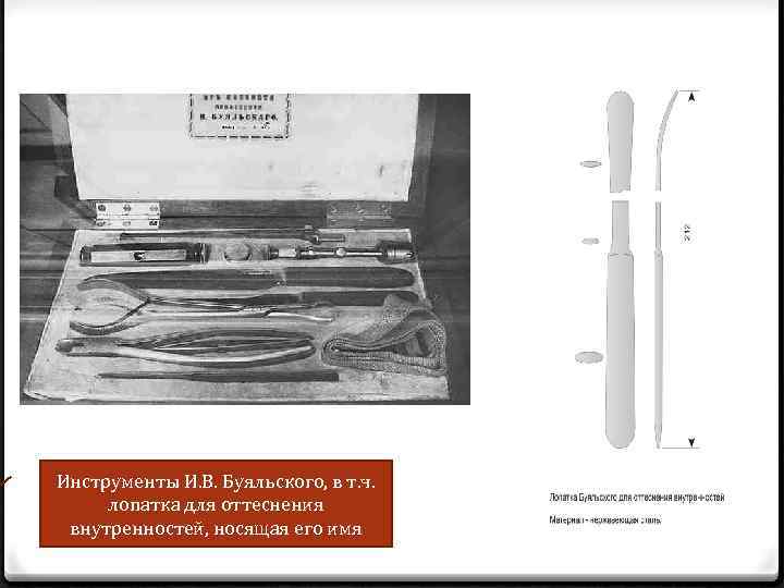 Инструменты И. В. Буяльского, в т. ч. лопатка для оттеснения внутренностей, носящая его имя