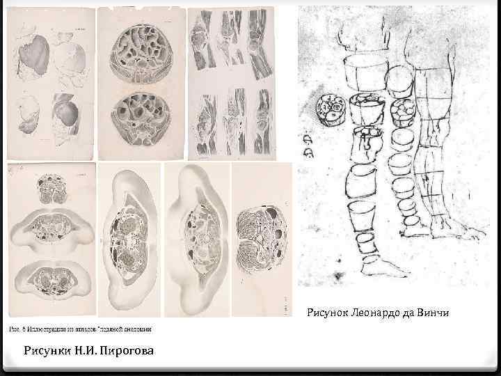 Рисунок Леонардо да Винчи Рисунки Н. И. Пирогова 