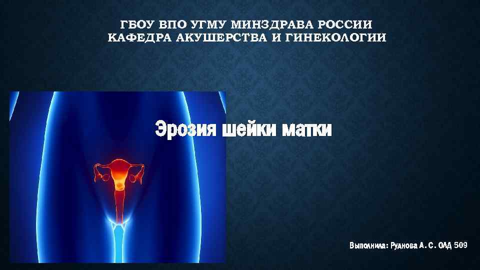 ГБОУ ВПО УГМУ МИНЗДРАВА РОССИИ КАФЕДРА АКУШЕРСТВА И ГИНЕКОЛОГИИ Эрозия шейки матки Выполнила: Руднова