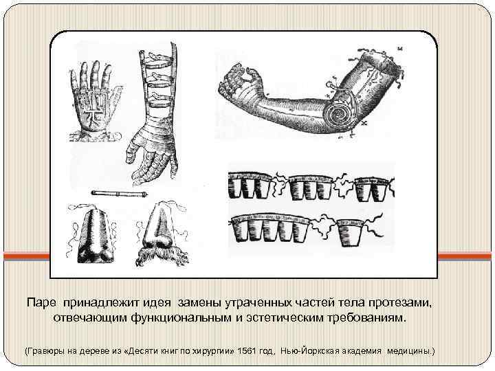 Паре принадлежит идея замены утраченных частей тела протезами, отвечающим функциональным и эстетическим требованиям. (Гравюры