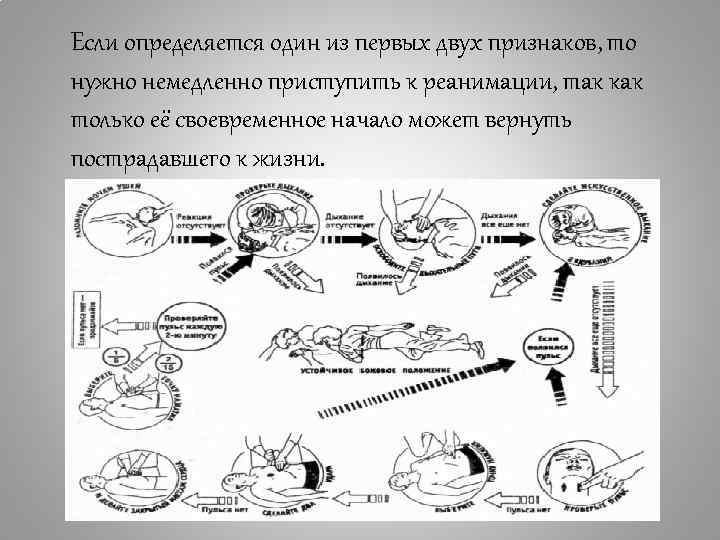 Если определяется один из первых двух признаков, то нужно немедленно приступить к реанимации, так