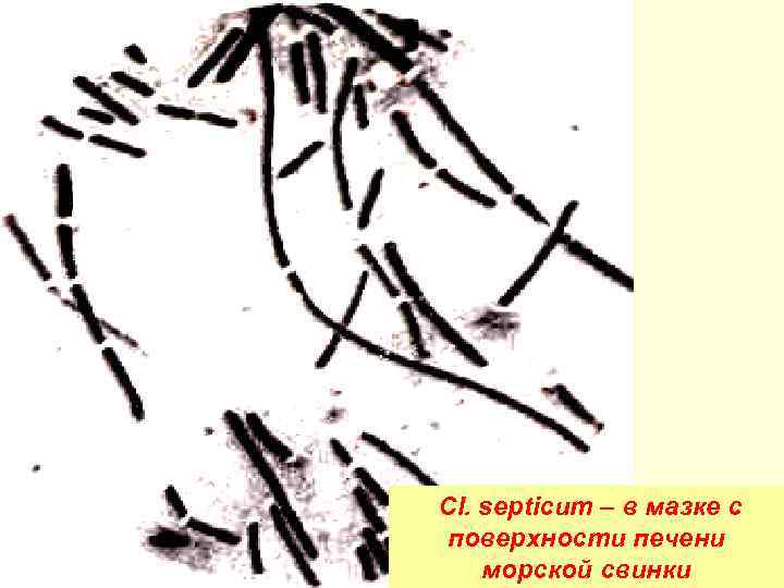 Cl. septicum – в мазке с поверхности печени 53 морской свинки 