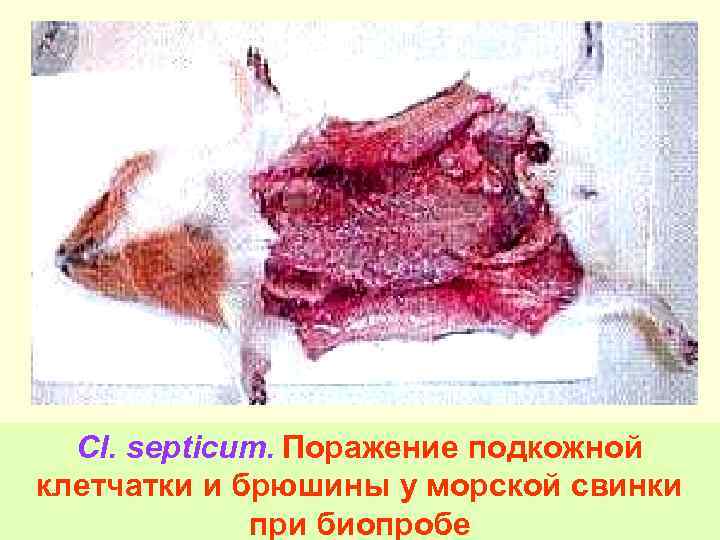 Cl. septicum. Поражение подкожной клетчатки и брюшины у морской свинки 57 при биопробе 