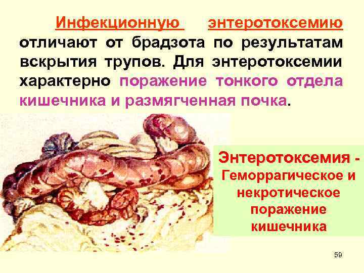 Инфекционную энтеротоксемию отличают от брадзота по результатам вскрытия трупов. Для энтеротоксемии характерно поражение тонкого