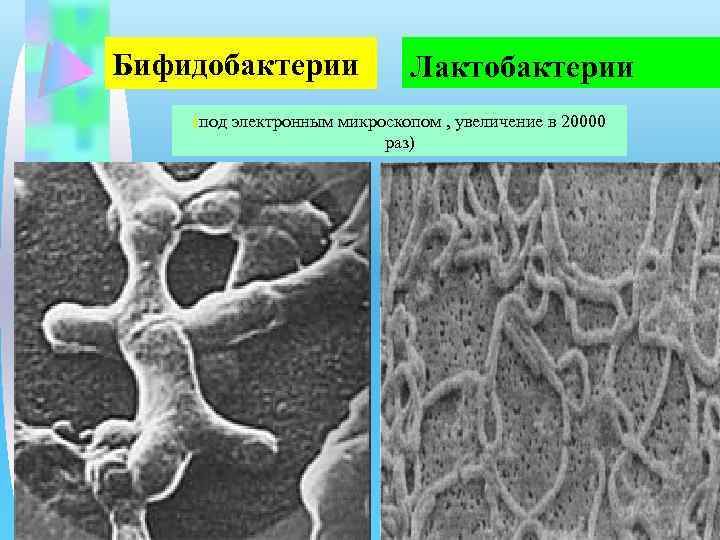 Бифидобактерии Лактобактерии (под электронным микроскопом , увеличение в 20000 раз) 