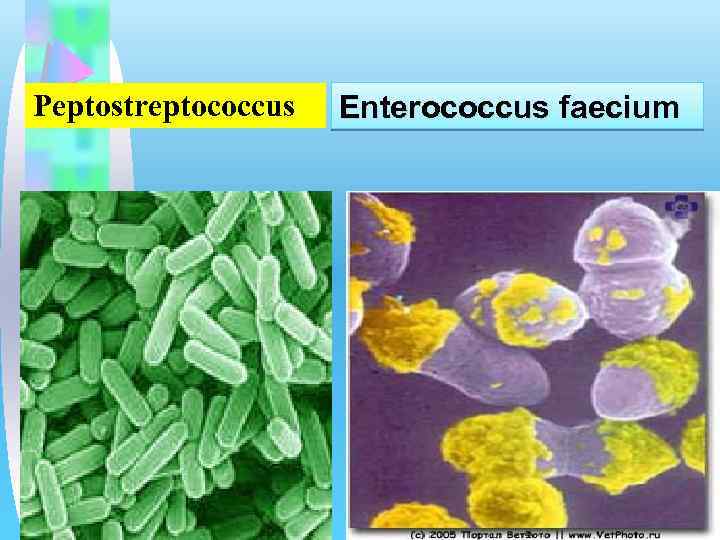 Peptostreptococcus Enterococcus faecium 