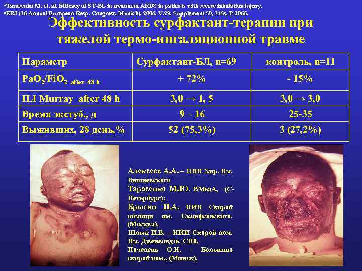  • Tarasenko M. еt. al. Efficacy of ST-BL in treatment ARDS in patients