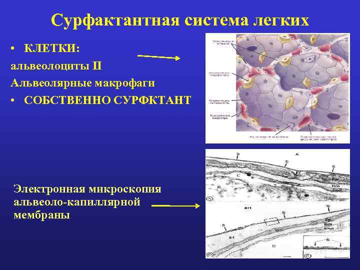 Сурфактантная система легких • КЛЕТКИ: альвеолоциты II Альвеолярные макрофаги • СОБСТВЕННО СУРФКТАНТ Электронная микроскопия