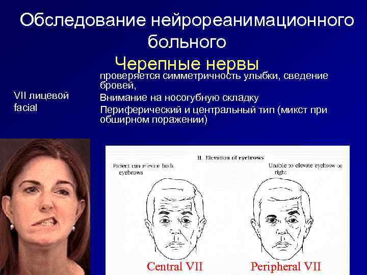 Обследование нейрореанимационного больного Черепные нервы сведение проверяется симметричность улыбки, VII лицевой facial бровей, Внимание