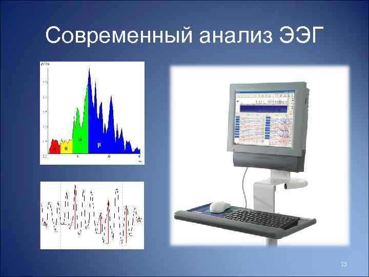 Современный анализ ЭЭГ 13 